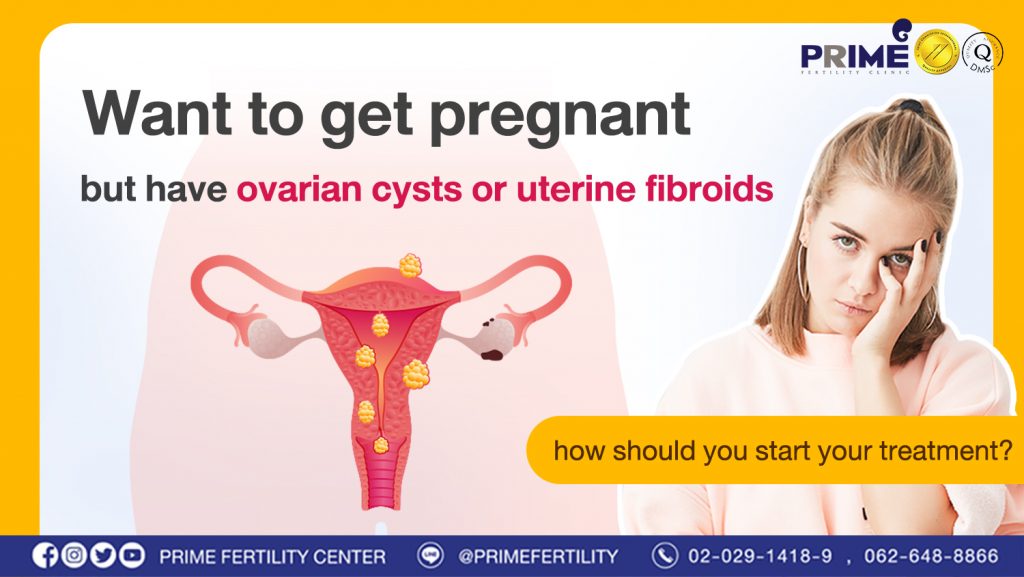 Want to get pregnant but have ovarian cysts or uterine fibroids, how should you start your treatment? - อยากมีลูก แต่เป็นซีสต์ เนื้องอก ควรเริ่มรักษาอย่างไรดี web อยากมีลูก แต่เป็นซีสต์ เนื้องอก ควรเริ่มรักษาอย่างไรดี web