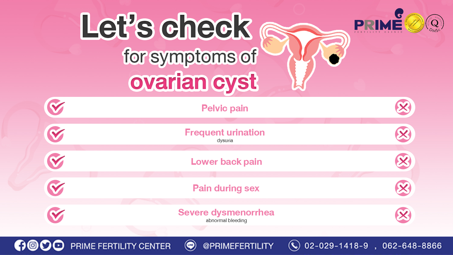 Let’s check for symptoms of ovarian cyst