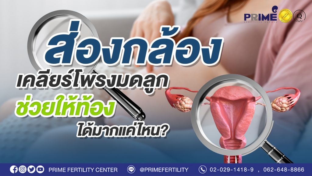 ส่องกล้องเคลียร์โพรงมดลูก ช่วยให้ท้องได้มากแค่ไหน web