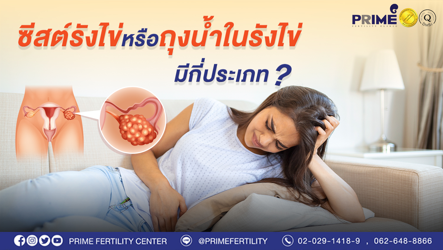 ซีสต์รังไข่หรือถุงน้ำในรังไข่ มีกี่ประเภท?