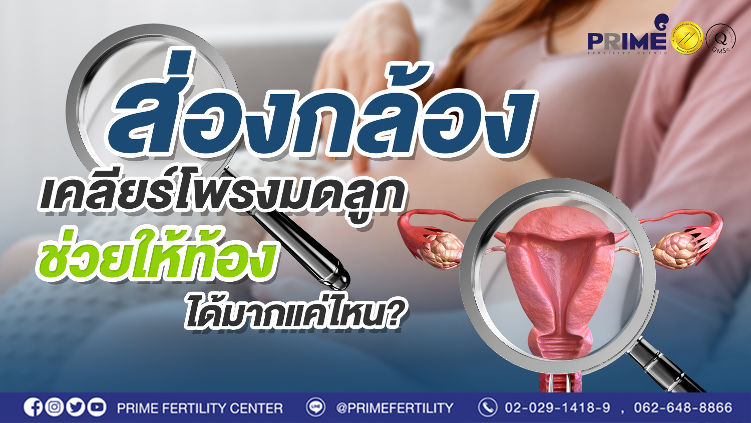 ส่องกล้องเคลียร์โพรงมดลูก ช่วยให้ท้องได้มากแค่ไหน?