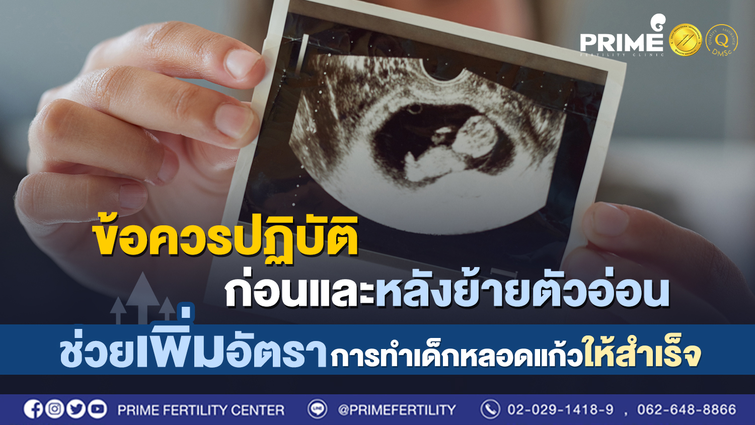 ข้อควรปฏิบัติก่อนและหลังย้ายตัวอ่อน ช่วยเพิ่มอัตราการทำเด็กหลอดแก้วให้สำเร็จ