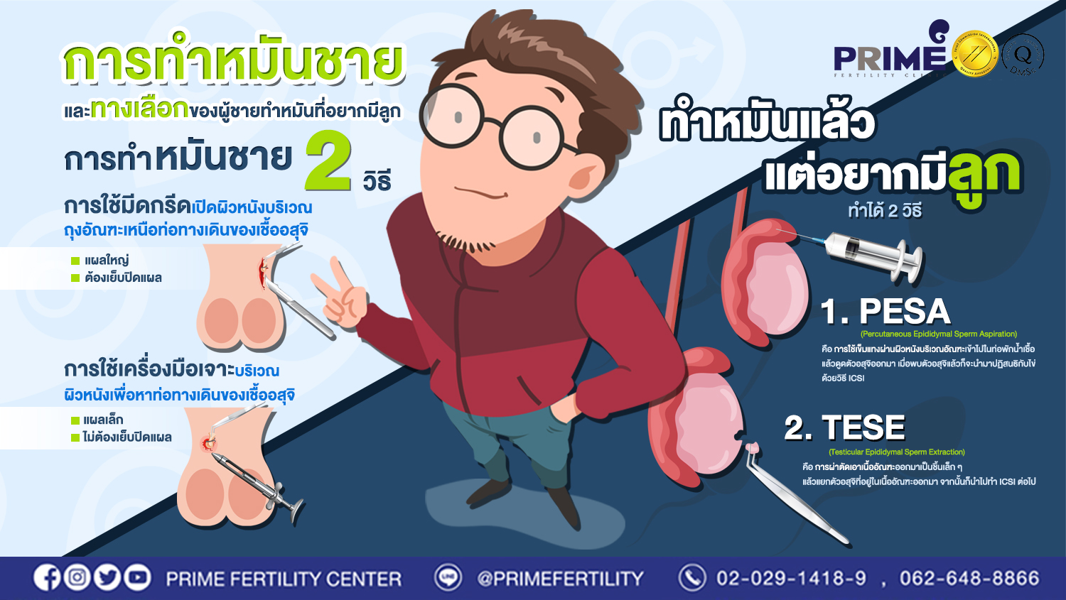 "หมันชาย" ทำได้กี่วิธี?
แล้วถ้าทำหมันแล้ว แต่อยากมีลูก ทำได้กี่วิธี?!