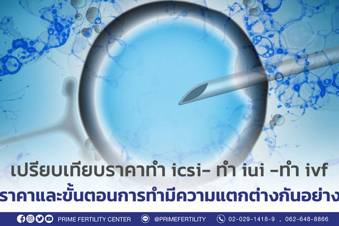 เปรียบเทียบราคาการทำ icsi ราคาของการทำ iui ราคาของการทำ ivf ราคาและขั้นตอนการทำมีความแตกต่างกันอย่าง