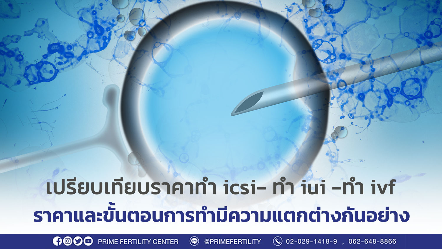 เปรียบเทียบราคา-icsi-iui-ivf/