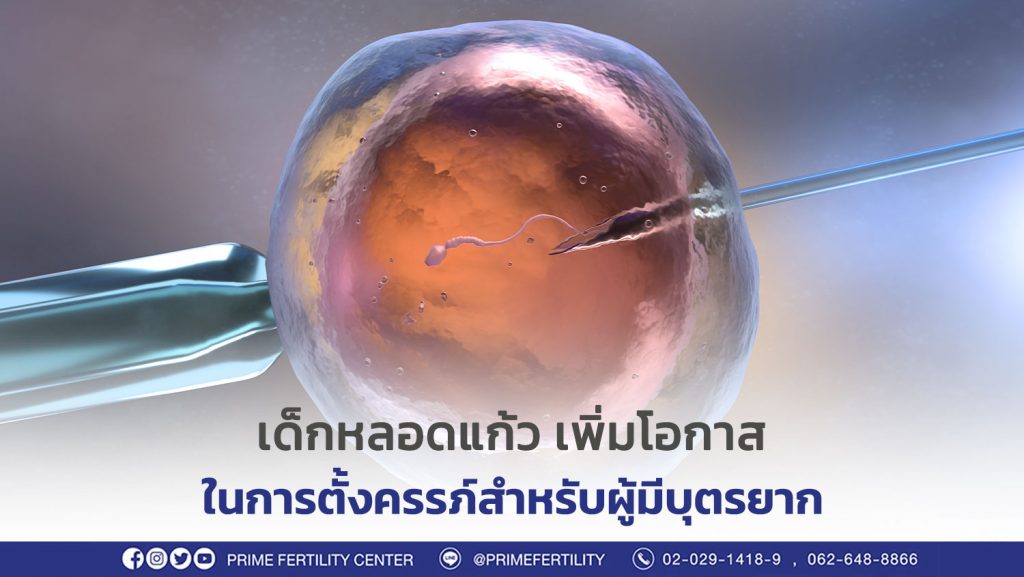 เด็กหลอดแก้ว ราคา