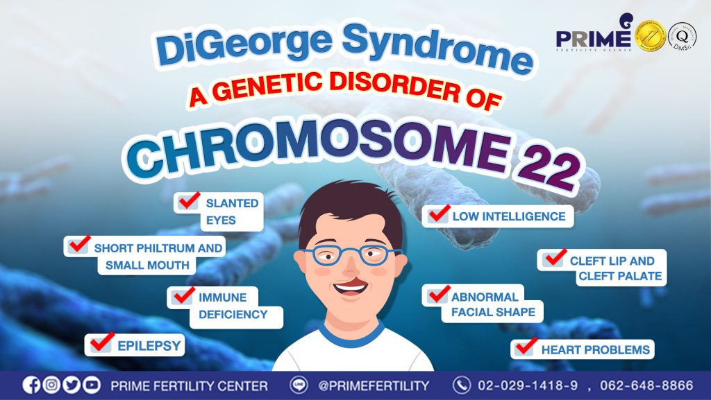 DiGeorge syndrome, a genetic disorder of chromosome 22 - DiGeorge syndrome ความผิดปกติของโครโมโซมคู่ที่ 22 web DiGeorge syndrome ความผิดปกติของโครโมโซมคู่ที่ 22 web