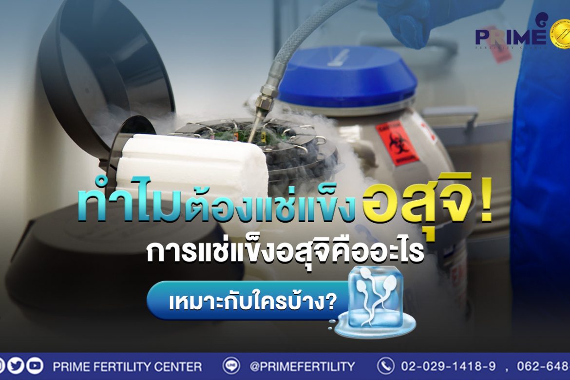 ทำไมต้องแช่แข็งอสุจิ! การแช่แข็งอสุจิคืออะไร? เหมาะกับใครบ้าง?