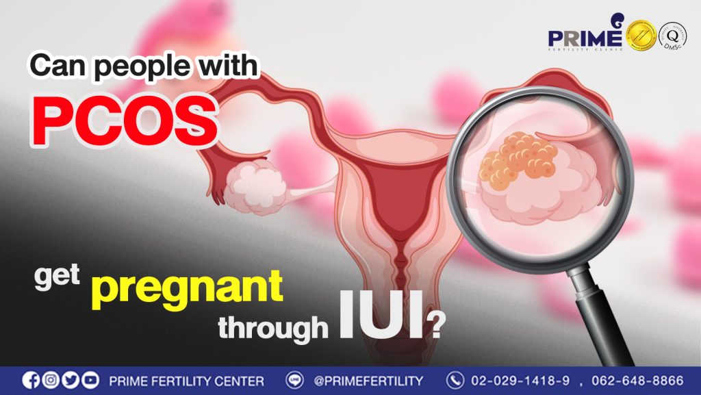 Can people with PCOS get pregnant through IUI? - เป็นโรคถุงน้ำในรังไข่ ทำ IUI แล้วมีโอกาสท้องได้หรือไม่ web เป็นโรคถุงน้ำในรังไข่ ทำ IUI แล้วมีโอกาสท้องได้หรือไม่ web