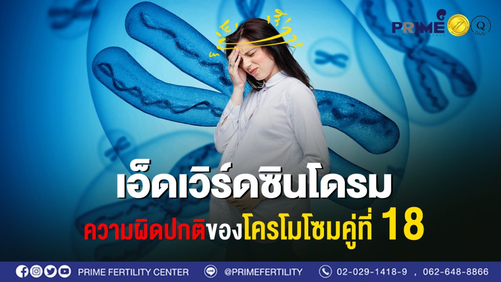 เอดเวิร์ดซินโดรม ความผิดปกติของโครโมโซมคู่ที่ 18 web