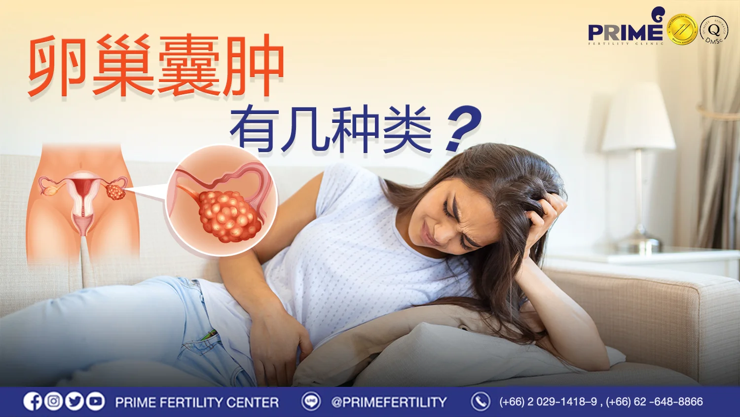卵巢囊肿有几种类型? - ซีสต์รังไข่หรือถุงน้ำรังไข่มีกี่ประเภท web ซีสต์รังไข่หรือถุงน้ำรังไข่มีกี่ประเภท web
