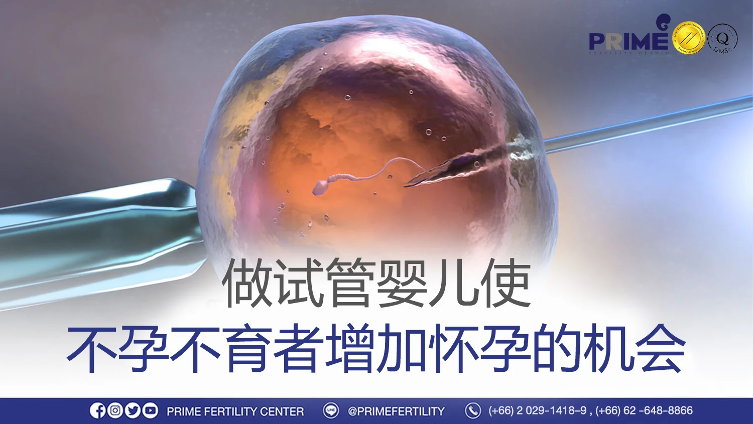 做试管婴儿使不孕不育者增加怀孕的机会 - เด็กหลอดแก้ว เพิ่มโอกาสในการตั้งครรภ์สำหรับผู้มีบุตรยาก เด็กหลอดแก้ว เพิ่มโอกาสในการตั้งครรภ์สำหรับผู้มีบุตรยาก
