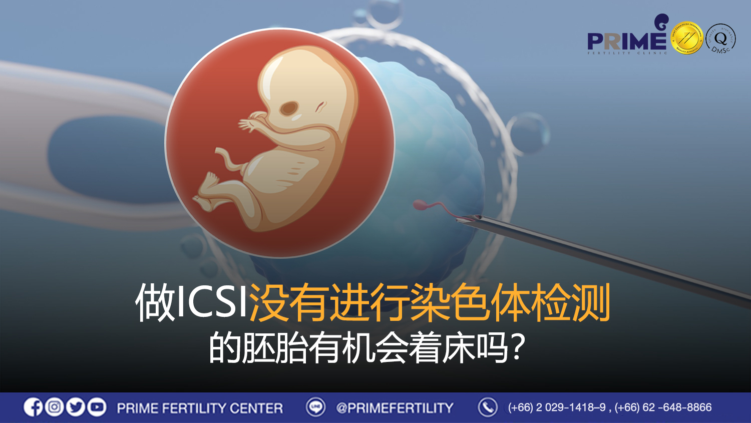 做ICSI没有进行染色体检测的胚胎有机会着床吗? - ตัวอ่อนที่ไม่ได้ตรวจโครโมโซม ทำ ICSI มีโอกาสติดหรือไม่ web ตัวอ่อนที่ไม่ได้ตรวจโครโมโซม ทำ ICSI มีโอกาสติดหรือไม่ web