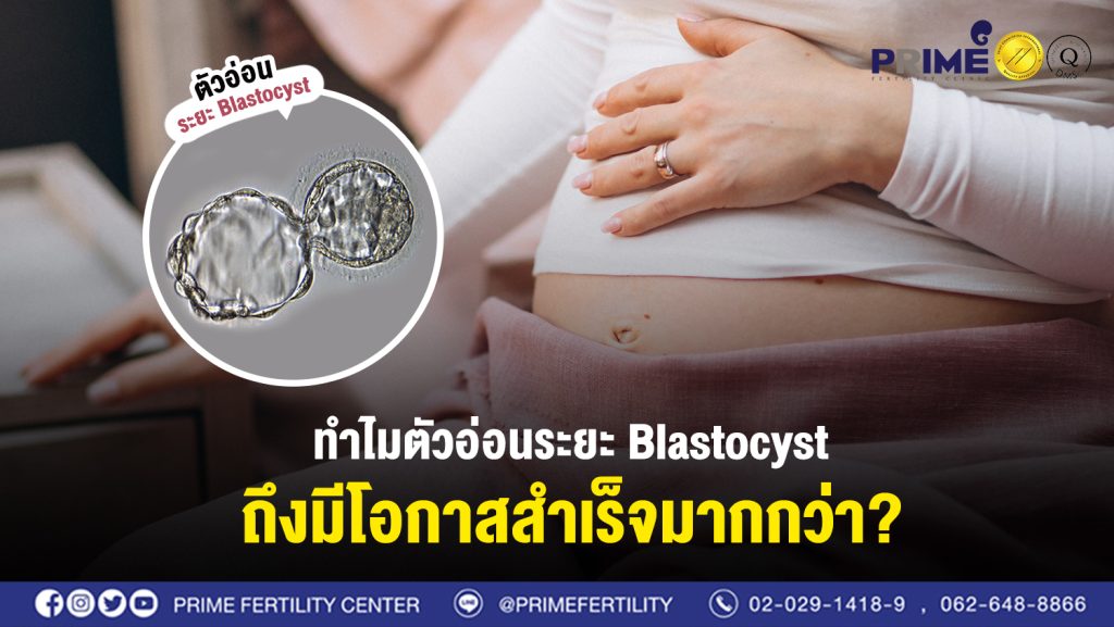 ทำไมตัวอ่อนระยะ Blastocyst ถึงมีโอกาสสำเร็จมากกว่า web