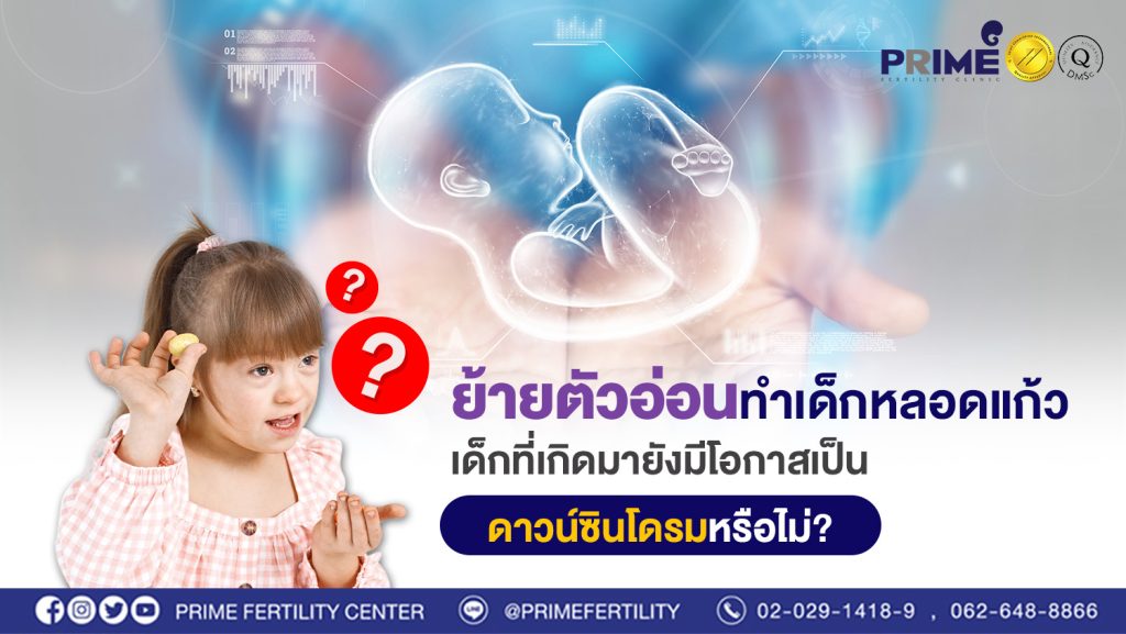 ย้ายตัวอ่อนทำเด็กหลอดแก้ว เด็กที่เกิดมายังมีโอกาสเป็นดาวน์ซินโดรมหรือไม่ web
