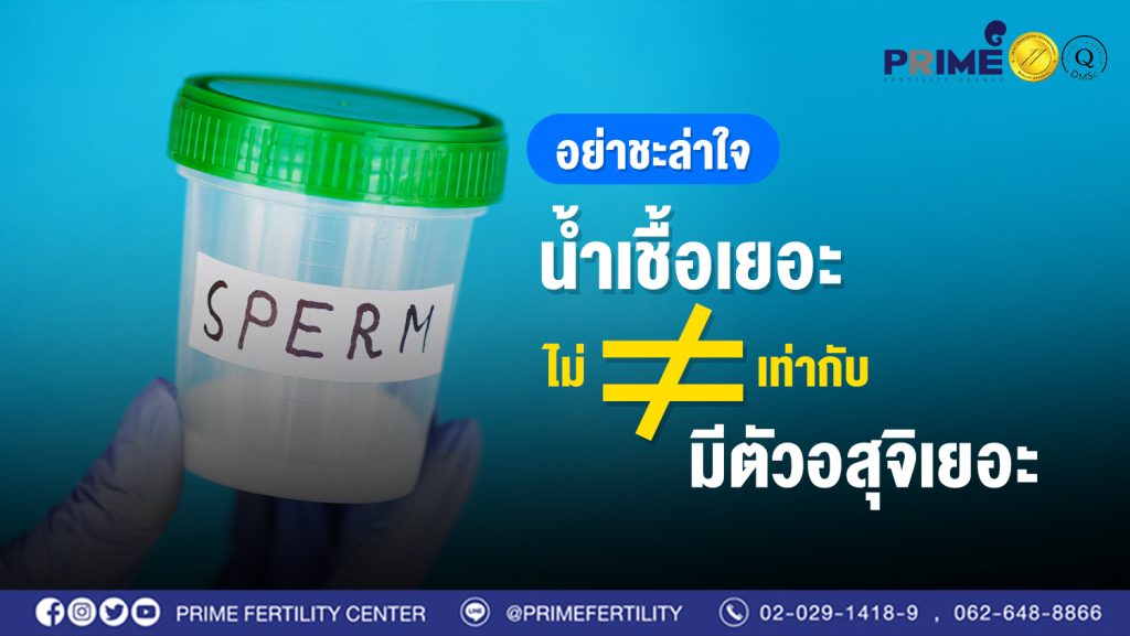 อย่าชะล่าใจ น้ำเชื้อเยอะ ไม่เท่ากับ มีตัวอสุจิเยอะ web
