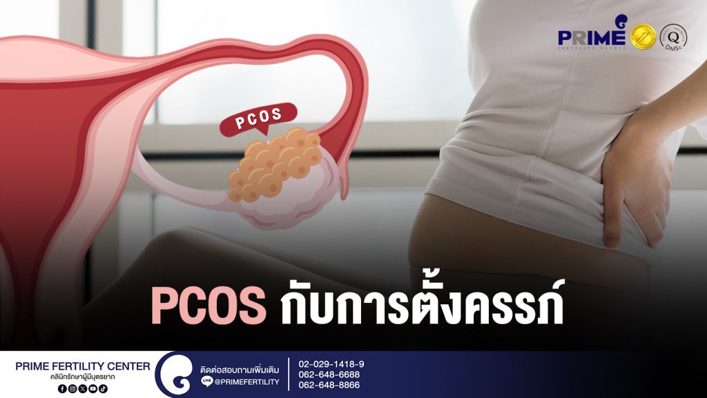 PCOS กับการตั้งครรภ์ web