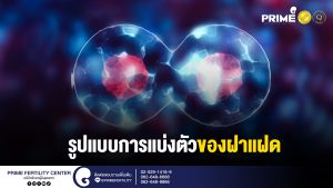 รูปแบบการแบ่งตัวของฝาแฝด web