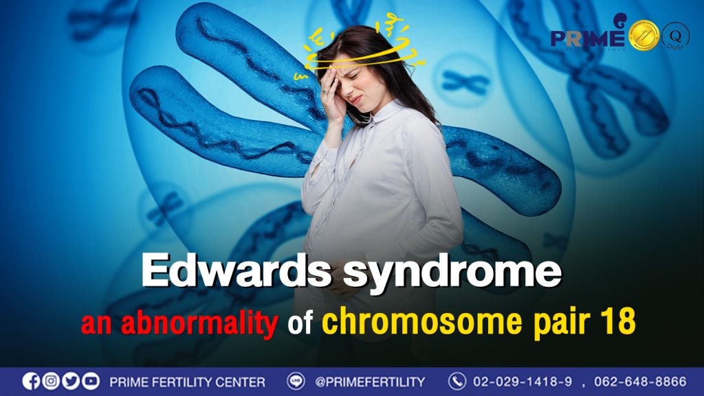 Edwards syndrome an abnormality of chromosome pair 18 - เอดเวิร์ดซินโดรม ความผิดปกติของโครโมโซมคู่ที่ 18 web เอดเวิร์ดซินโดรม ความผิดปกติของโครโมโซมคู่ที่ 18 web