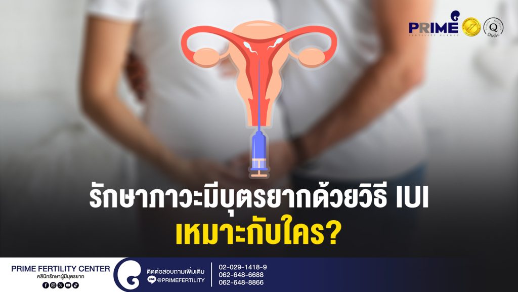 รักษาภาวะมีบุตรยากด้วยวิธี IUI เหมาะกับใคร web