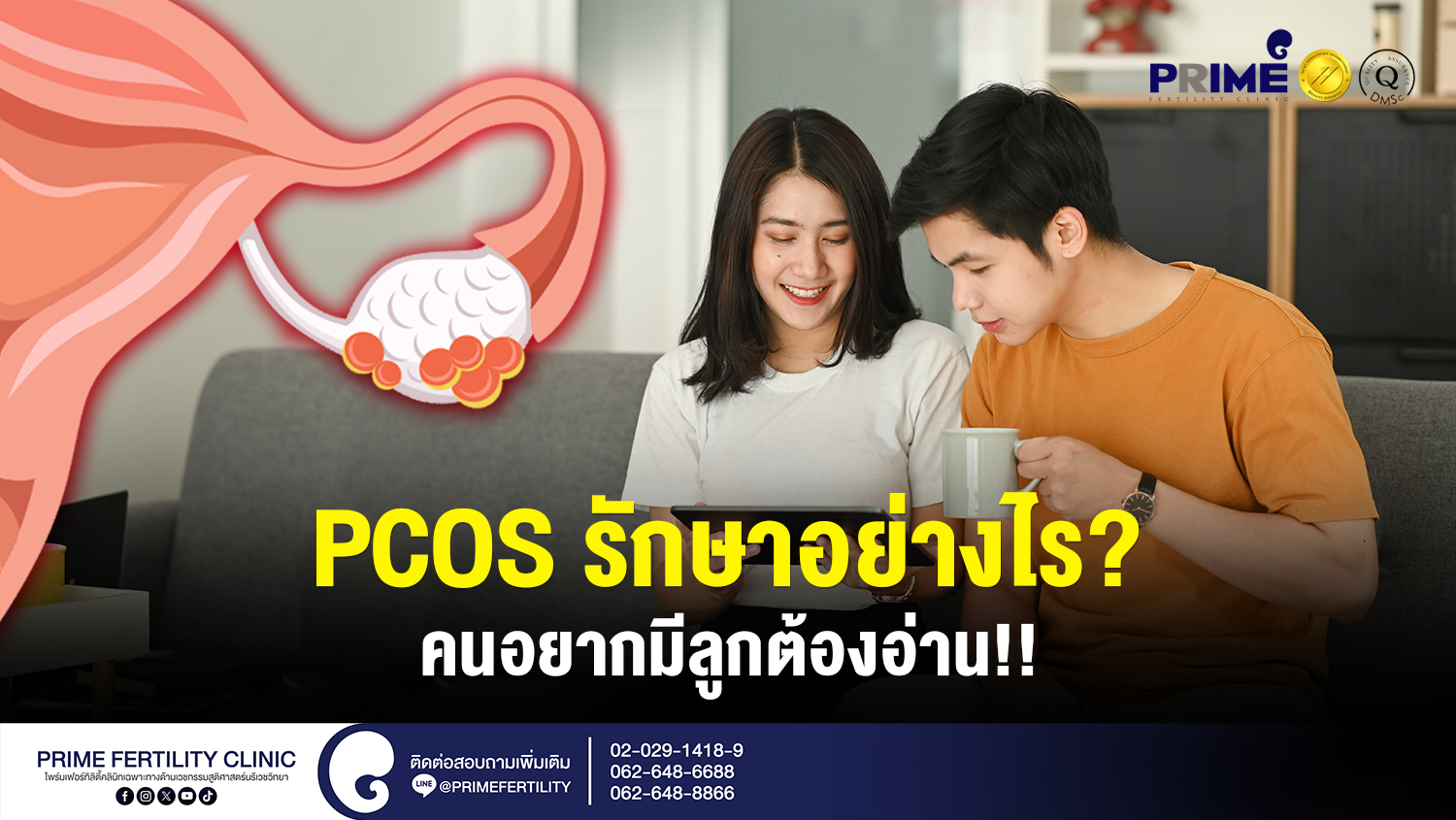 PCOS รักษาอย่างไร? คนอยากมีลูกต้องอ่าน!! - PCOS รักษาอย่างไร คนอยากมีลูกต้องอ่าน web PCOS รักษาอย่างไร คนอยากมีลูกต้องอ่าน web
