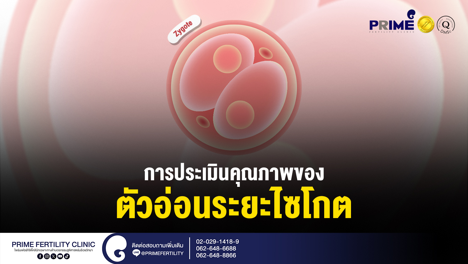 การประเมินคุณภาพของตัวอ่อนระยะไซโกต (Zygote) - การประเมินคุณภาพของตัวอ่อนระยะไซโกต web การประเมินคุณภาพของตัวอ่อนระยะไซโกต web