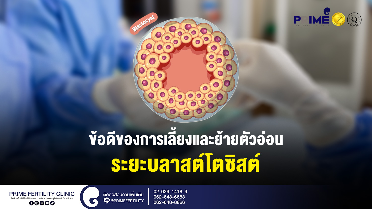 ข้อดีของการเลี้ยงตัวอ่อนถึงระยะบลาสต์โตซิสต์ (Blastocyst culture) - Lab ข้อดีของการเลี้ยงและย้ายตัวอ่อนระยะบลาสต์โตซิสต์ web Lab ข้อดีของการเลี้ยงและย้ายตัวอ่อนระยะบลาสต์โตซิสต์ web