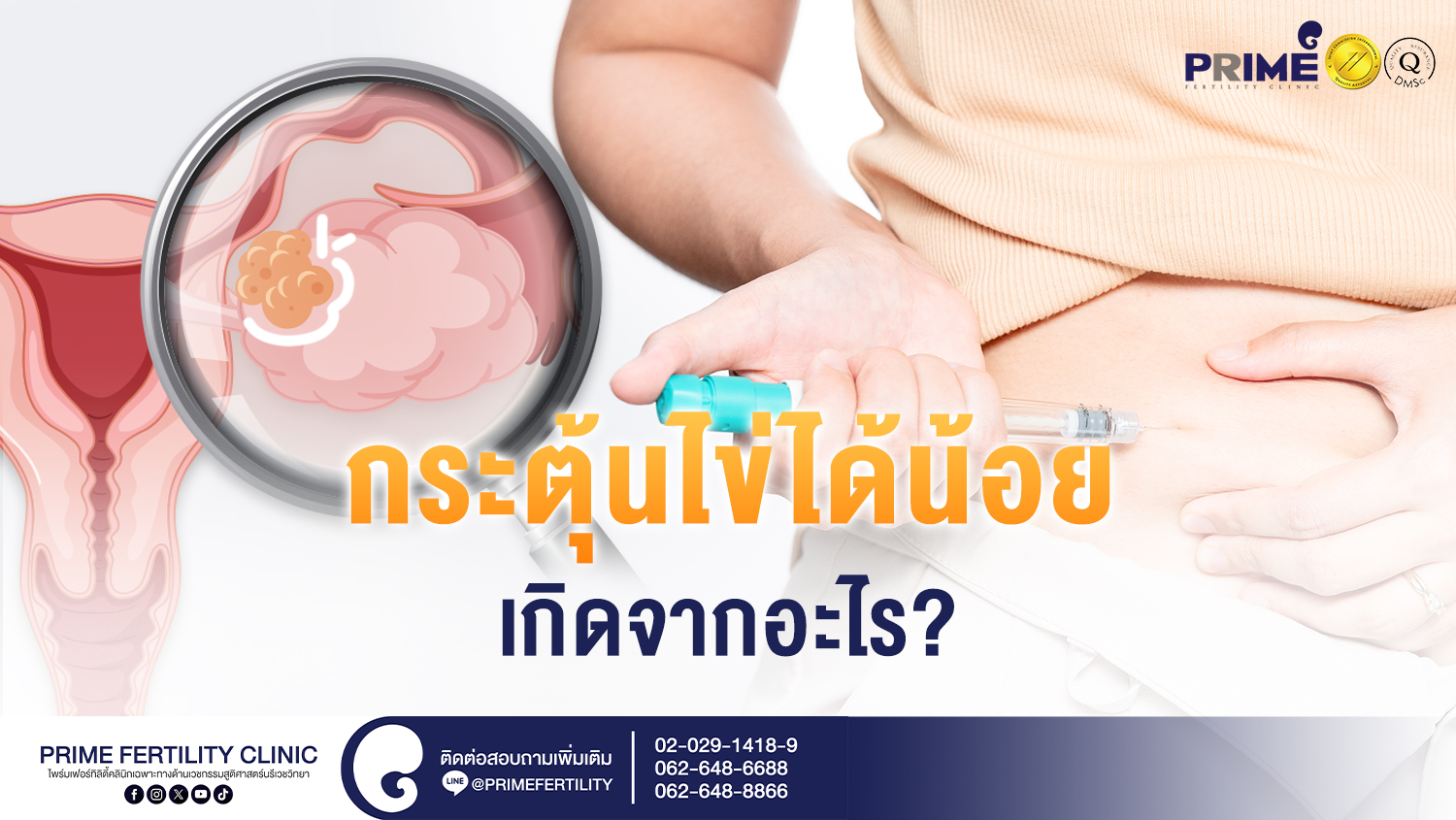 กระตุ้นไข่ได้น้อย เกิดจากอะไร? - กระตุ้นไข่ได้น้อยเกิดจากอะไร เวป กระตุ้นไข่ได้น้อยเกิดจากอะไร เวป