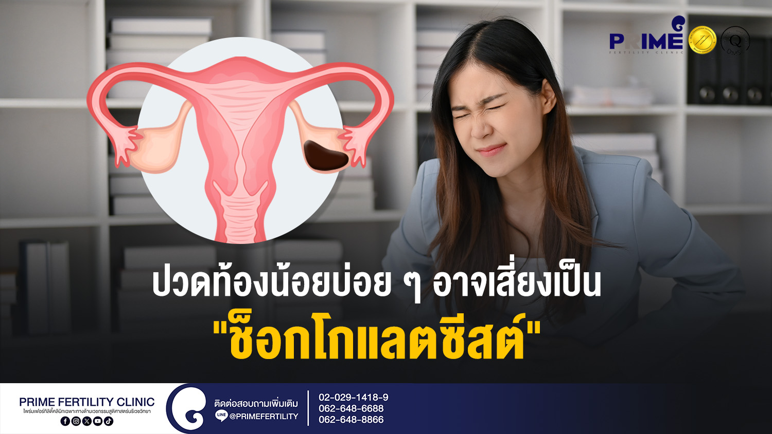ปวดท้องน้อยบ่อย ๆ อาจเสี่ยงเป็น “ช็อกโกแลตซีสต์” - ปวดท้องน้อยบ่อย ๆ อาจเสี่ยงเป็น ช็อกโกแลตซีสต์ web ปวดท้องน้อยบ่อย ๆ อาจเสี่ยงเป็น ช็อกโกแลตซีสต์ web