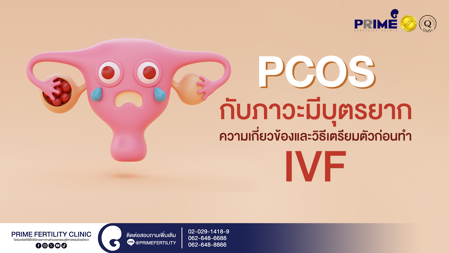 PCOS กับภาวะมีบุตรยาก ความเกี่ยวข้องและวิธีเตรียมตัวก่อนทำ IVF - SEO PCOS กับภาวะมีบุตรยาก ความเกี่ยวข้องและวิธีเตรียมตัวก่อนทำ IVF web SEO PCOS กับภาวะมีบุตรยาก ความเกี่ยวข้องและวิธีเตรียมตัวก่อนทำ IVF web