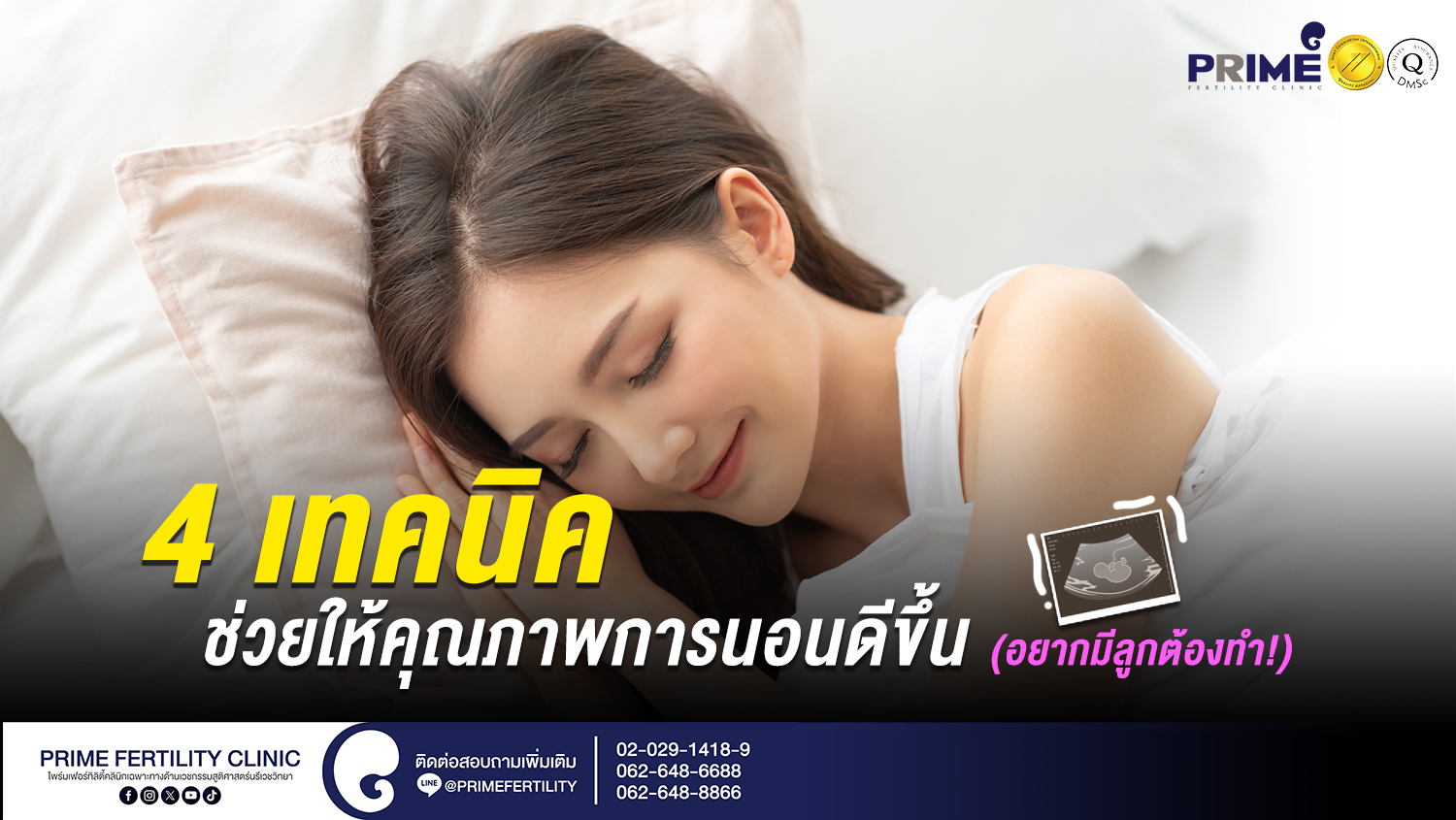 4 เทคนิค ช่วยให้คุณภาพการนอนดีขึ้น (อยากมีลูกต้องทำ!!) - 4เทคนิคการนอน web 4เทคนิคการนอน web