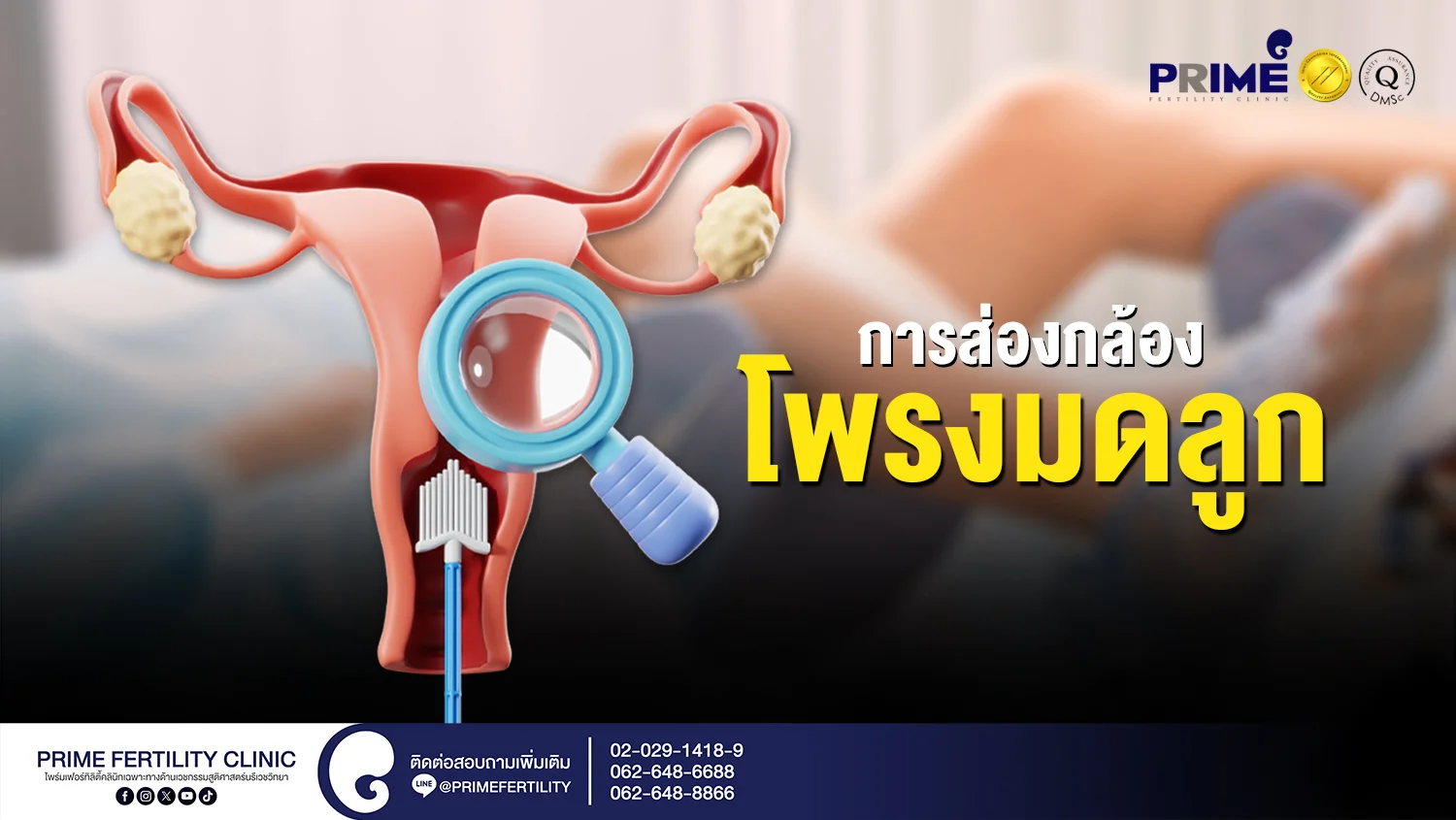 การส่องกล้องโพรงมดลูก - การส่องกล้องโพรงมดลูก web การส่องกล้องโพรงมดลูก web