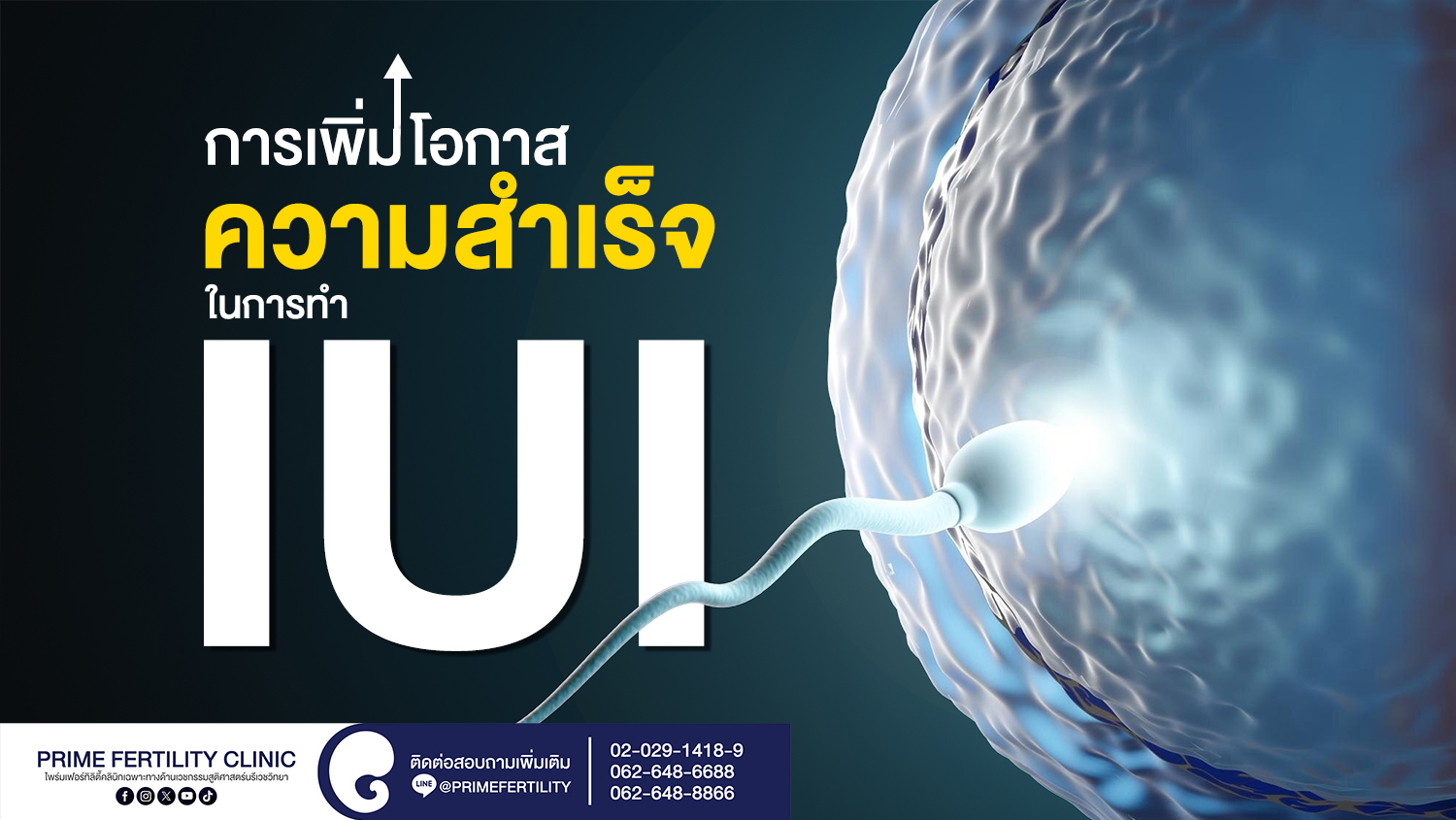 การเพิ่มโอกาสความสำเร็จในการทำ IUI - การเพิ่มโอกาสความสำเร็จในการทำ IUI web การเพิ่มโอกาสความสำเร็จในการทำ IUI web