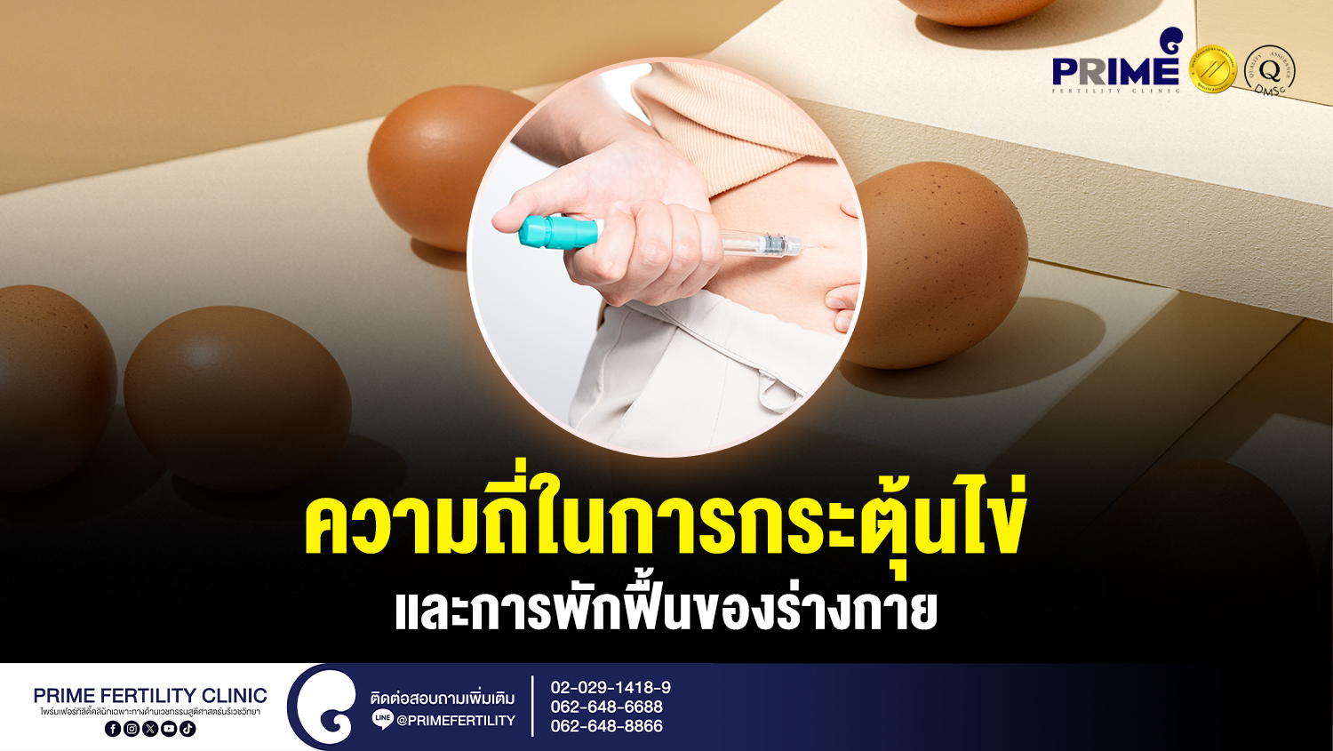 ความถี่ในการกระตุ้นไข่และการพักร่างกายในผู้มีบุตรยาก - ความถี่ในการกระตุ้นไข่และการพักฟื้นของร่างกาย web ความถี่ในการกระตุ้นไข่และการพักฟื้นของร่างกาย web