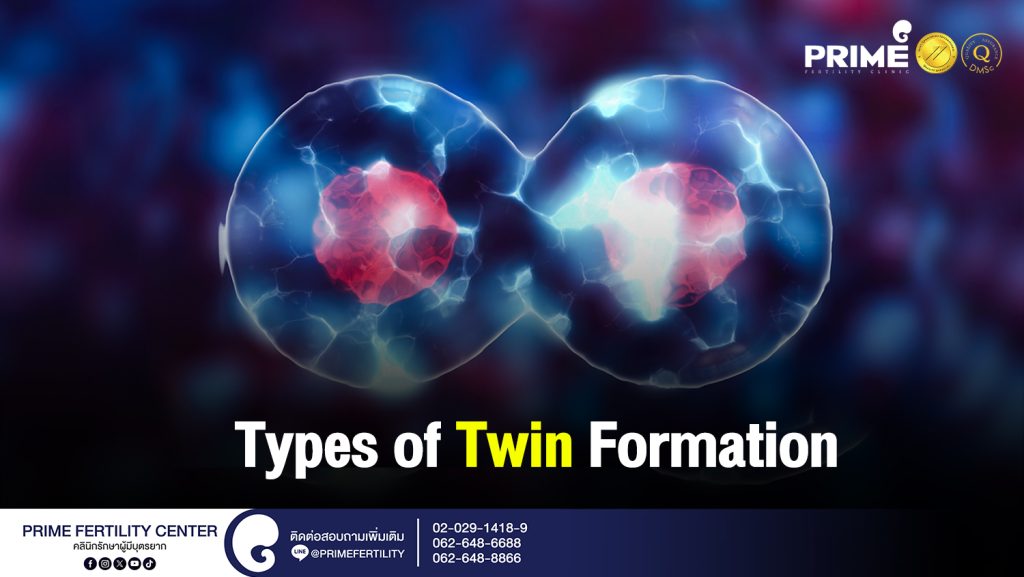 Types of Twin Formation - รูปแบบการแบ่งตัวของฝาแฝด web รูปแบบการแบ่งตัวของฝาแฝด web