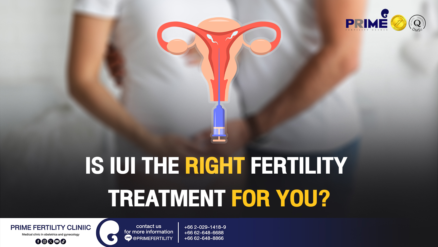 Is IUI the Right Fertility Treatment for You? - รักษาภาวะมีบุตรยากด้วยวิธี IUI เหมาะกับใคร web รักษาภาวะมีบุตรยากด้วยวิธี IUI เหมาะกับใคร web